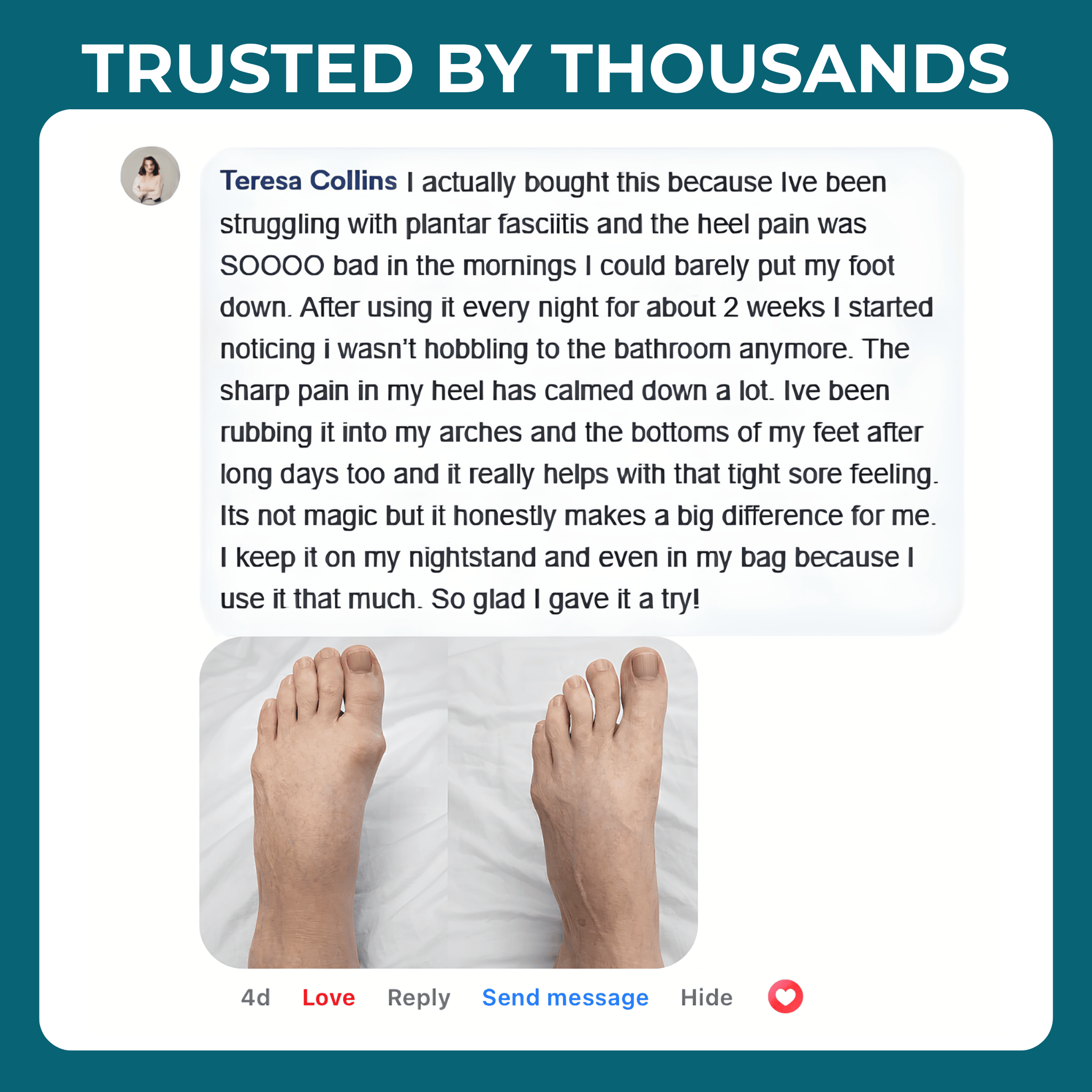 Senzio Miracle Balm™ Foot Recovery Formula - SenzioSenzioSenzio Miracle Balm™ Foot Recovery Formula